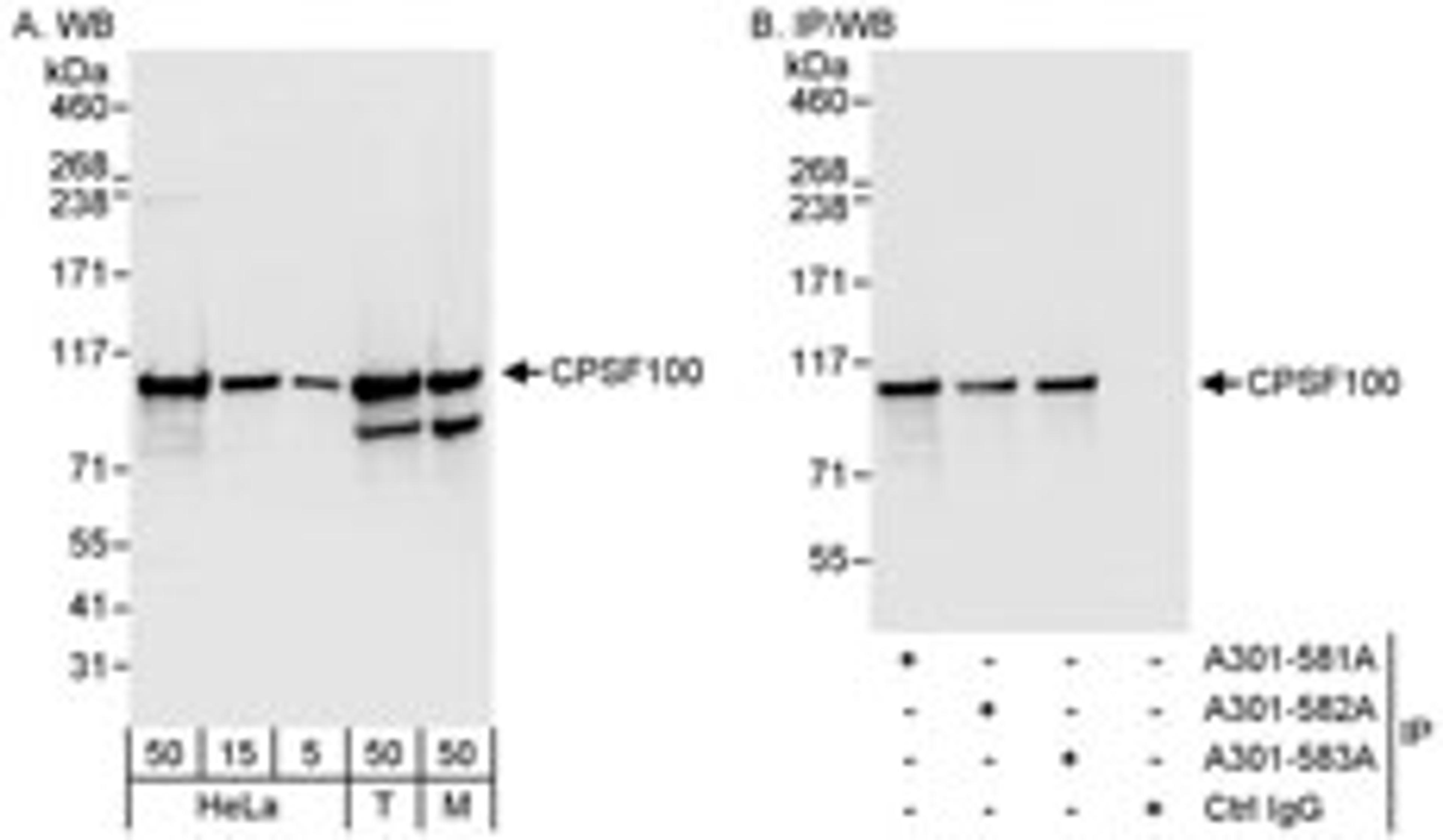 Detection of human and mouse CPSF100 by western blot (h&m) and immunoprecipitation (h).