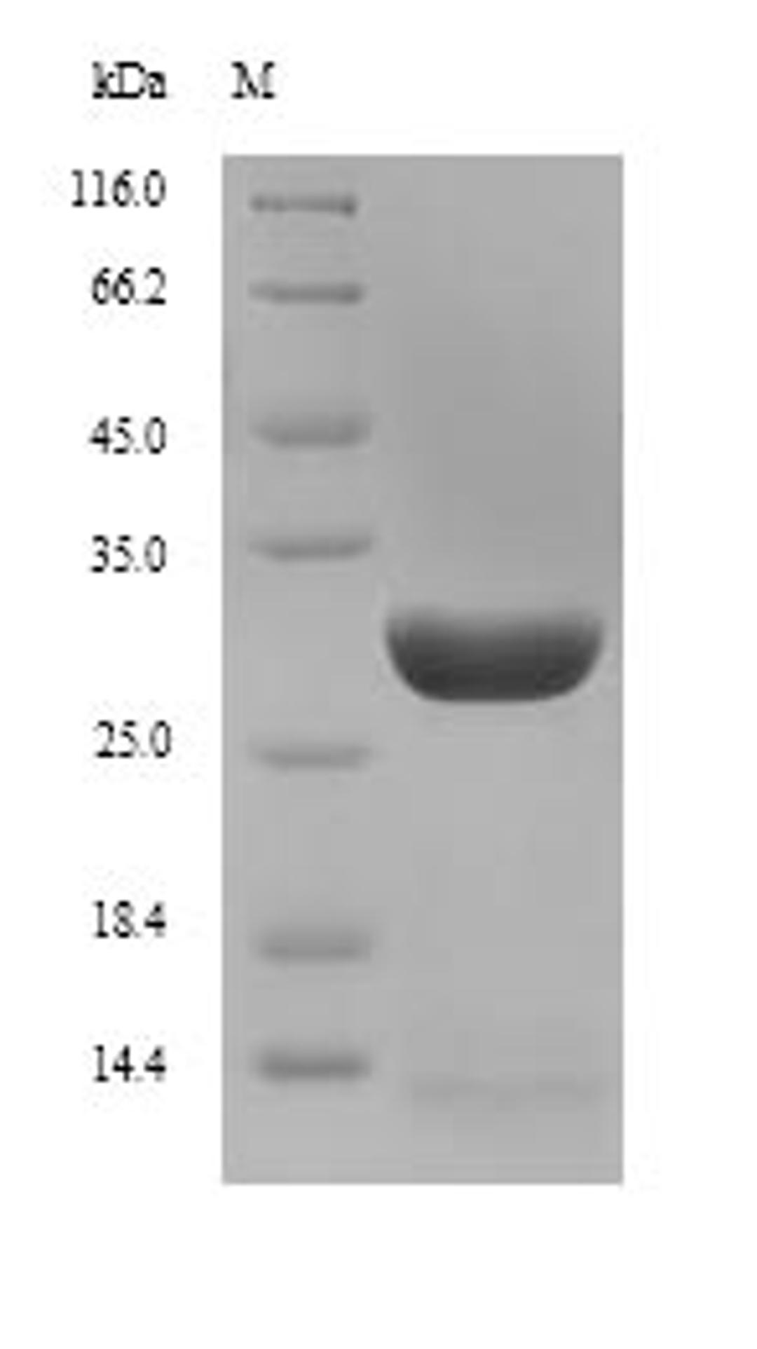 (Tris-Glycine gel) Discontinuous SDS-PAGE (reduced) with 5% enrichment gel and 15% separation gel.