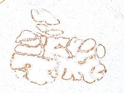 Immunohistochemistry-Paraffin: Cytokeratin 14 Antibody (LL002) [NBP2-34270] - Formalin-fixed, paraffin-embedded human prostate (10X) stained with Cytokeratin 14 MAb (LL002).