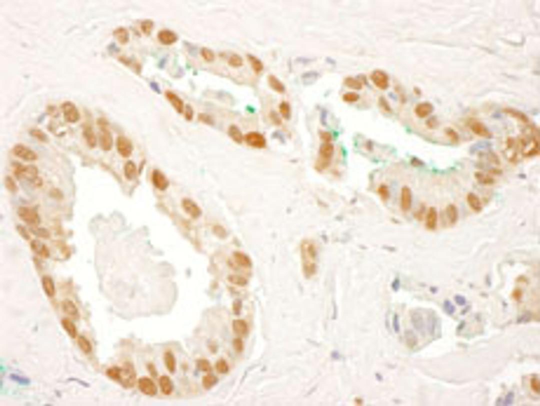 Detection of human RAD23B by immunohistochemistry.