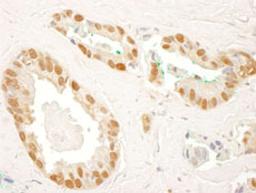 Detection of human RAD23B by immunohistochemistry.