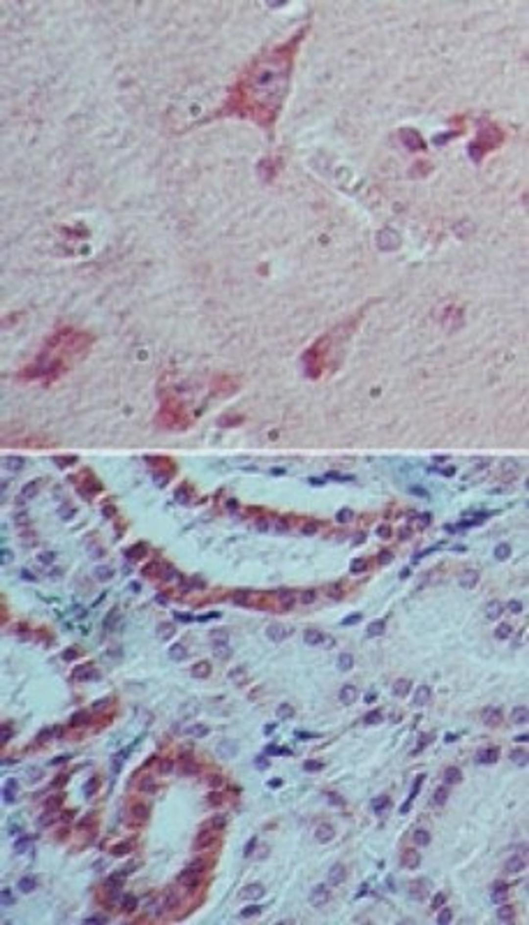 Immunohistochemistry-Paraffin: IL22 Antibody (8F11E2) [NBP2-27339] - analysis of IL-22 in human brain (top) and kidney tissue (bottom) using IL-22 antibody at 5 ug/ml.