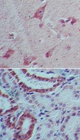 Immunohistochemistry-Paraffin: IL22 Antibody (8F11E2) [NBP2-27339] - analysis of IL-22 in human brain (top) and kidney tissue (bottom) using IL-22 antibody at 5 ug/ml.