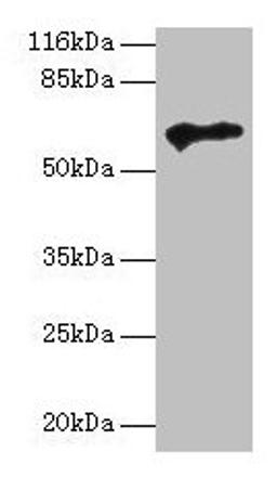 Western blot. All lanes: TPTE antibody at 2µg/ml + HepG2 whole cell lysate. Secondary. Goat polyclonal to rabbit IgG at 1/10000 dilution. Predicted band size: 65, 63, 61, 50 kDa. Observed band size: 65 kDa