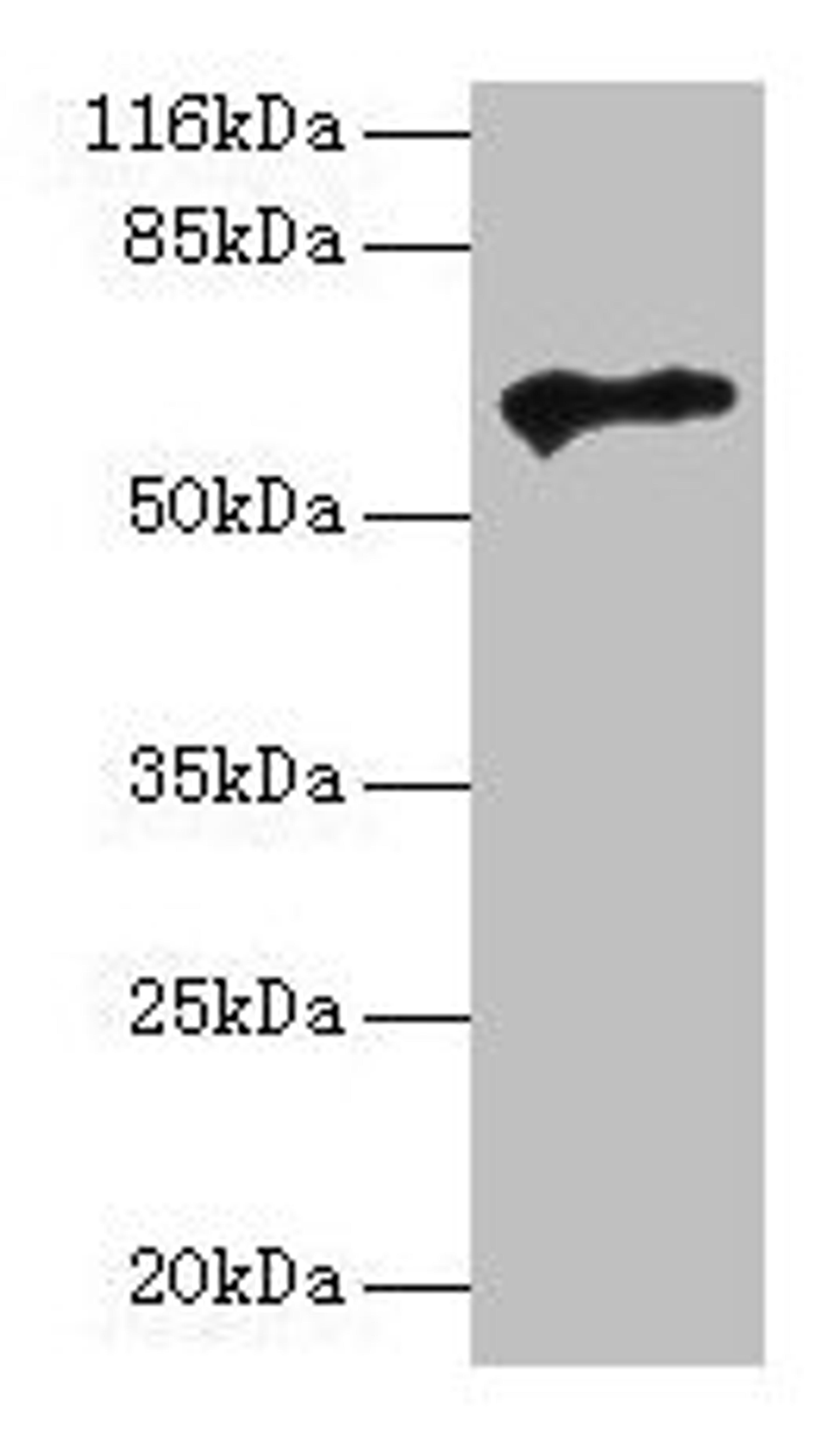 Western blot. All lanes: TPTE antibody at 2µg/ml + HepG2 whole cell lysate. Secondary. Goat polyclonal to rabbit IgG at 1/10000 dilution. Predicted band size: 65, 63, 61, 50 kDa. Observed band size: 65 kDa