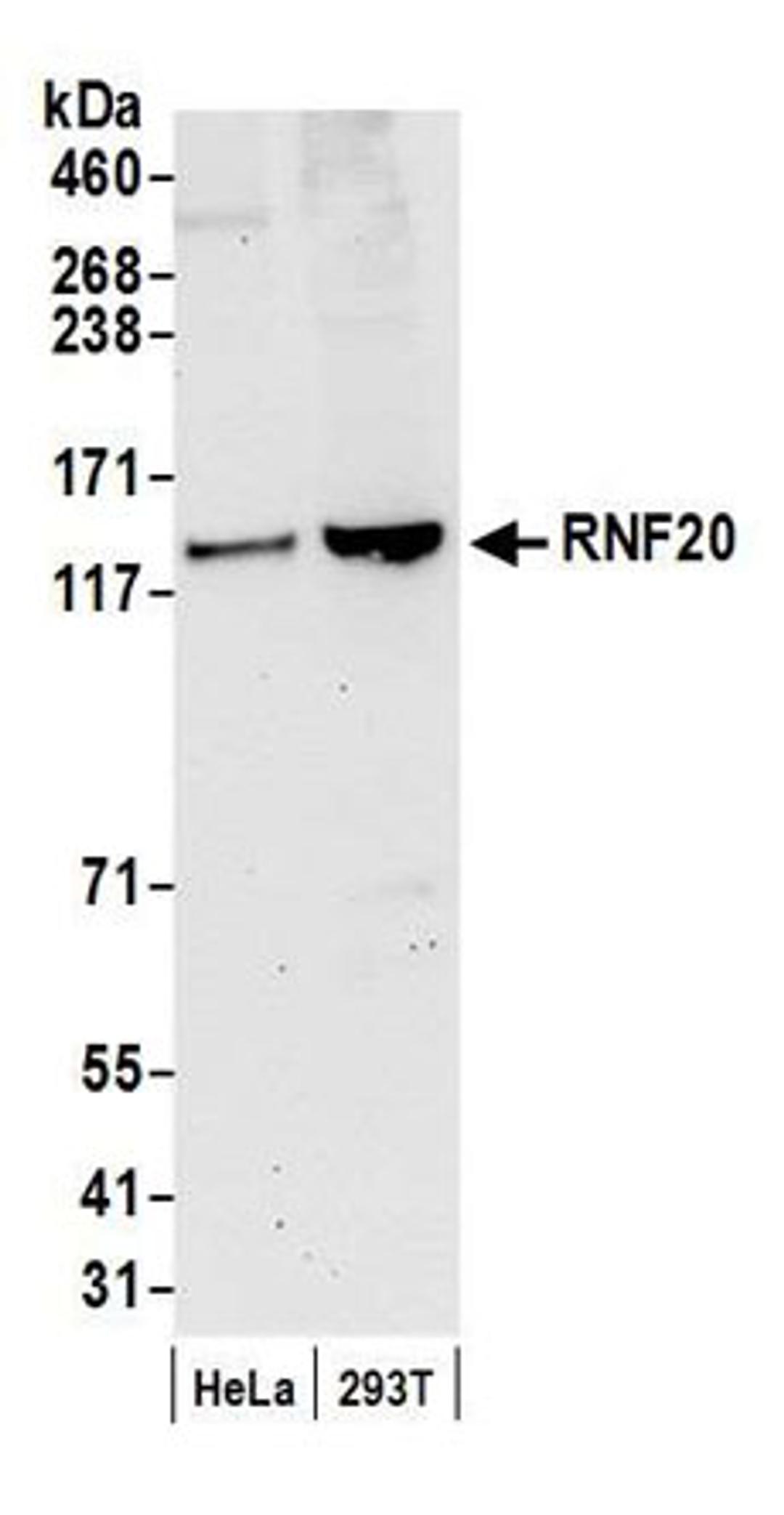 Detection of human RNF20 by western blot.