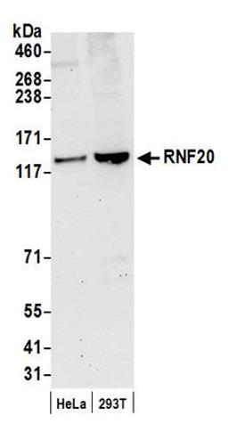 Detection of human RNF20 by western blot.