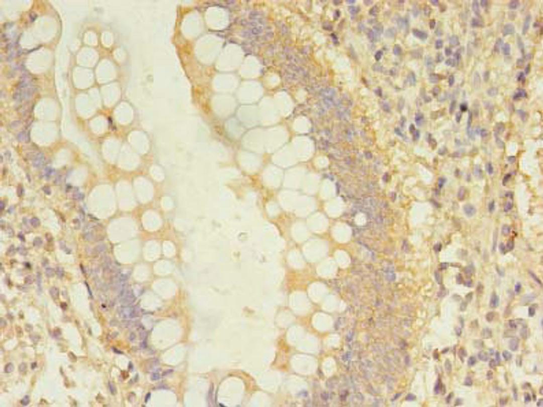 Immunohistochemistry of paraffin-embedded human small intestine tissue using CSB-PA614427LA01HU at dilution of 1:100