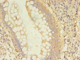 Immunohistochemistry of paraffin-embedded human small intestine tissue using CSB-PA614427LA01HU at dilution of 1:100