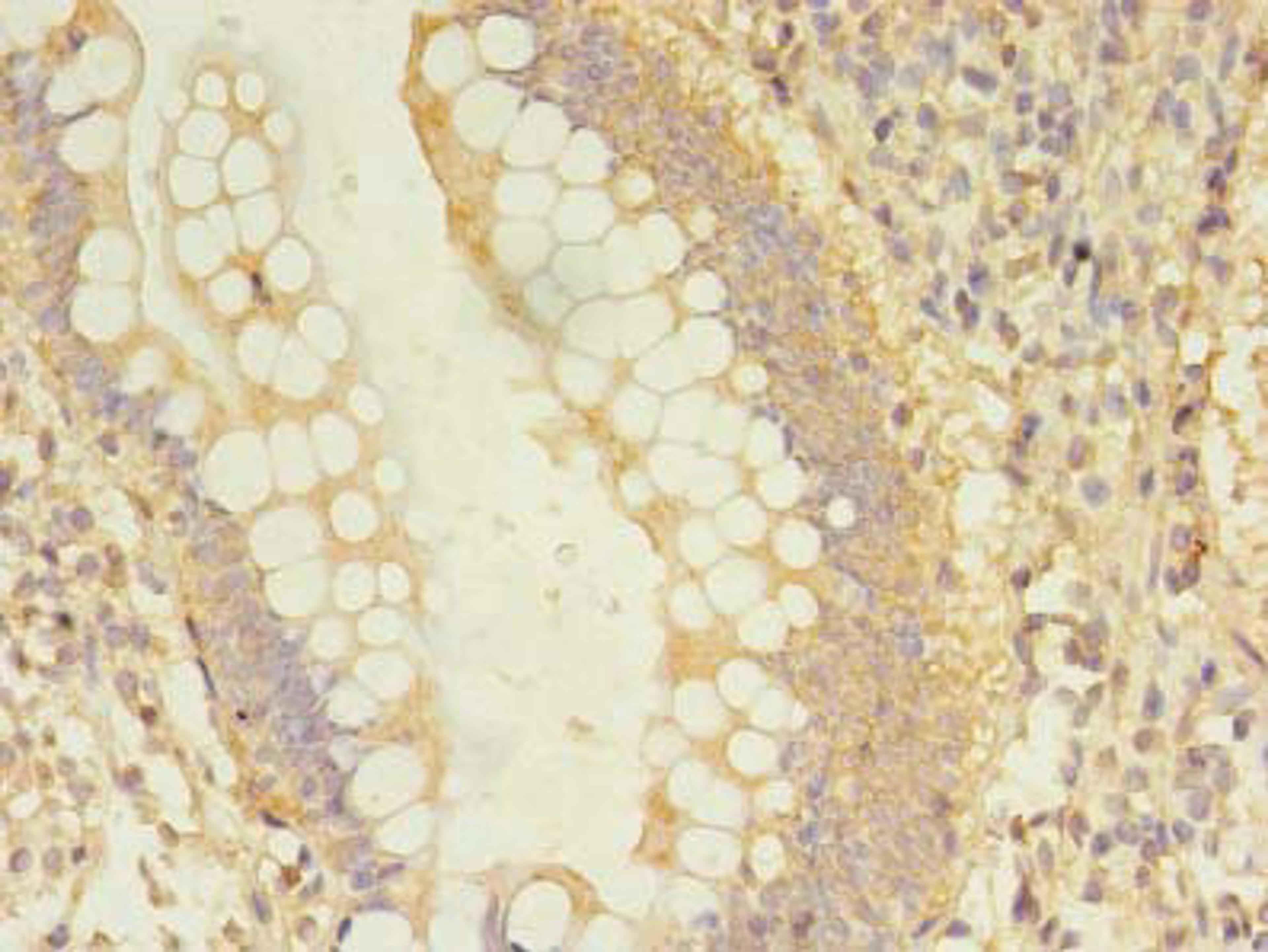 Immunohistochemistry of paraffin-embedded human small intestine tissue using CSB-PA614427LA01HU at dilution of 1:100