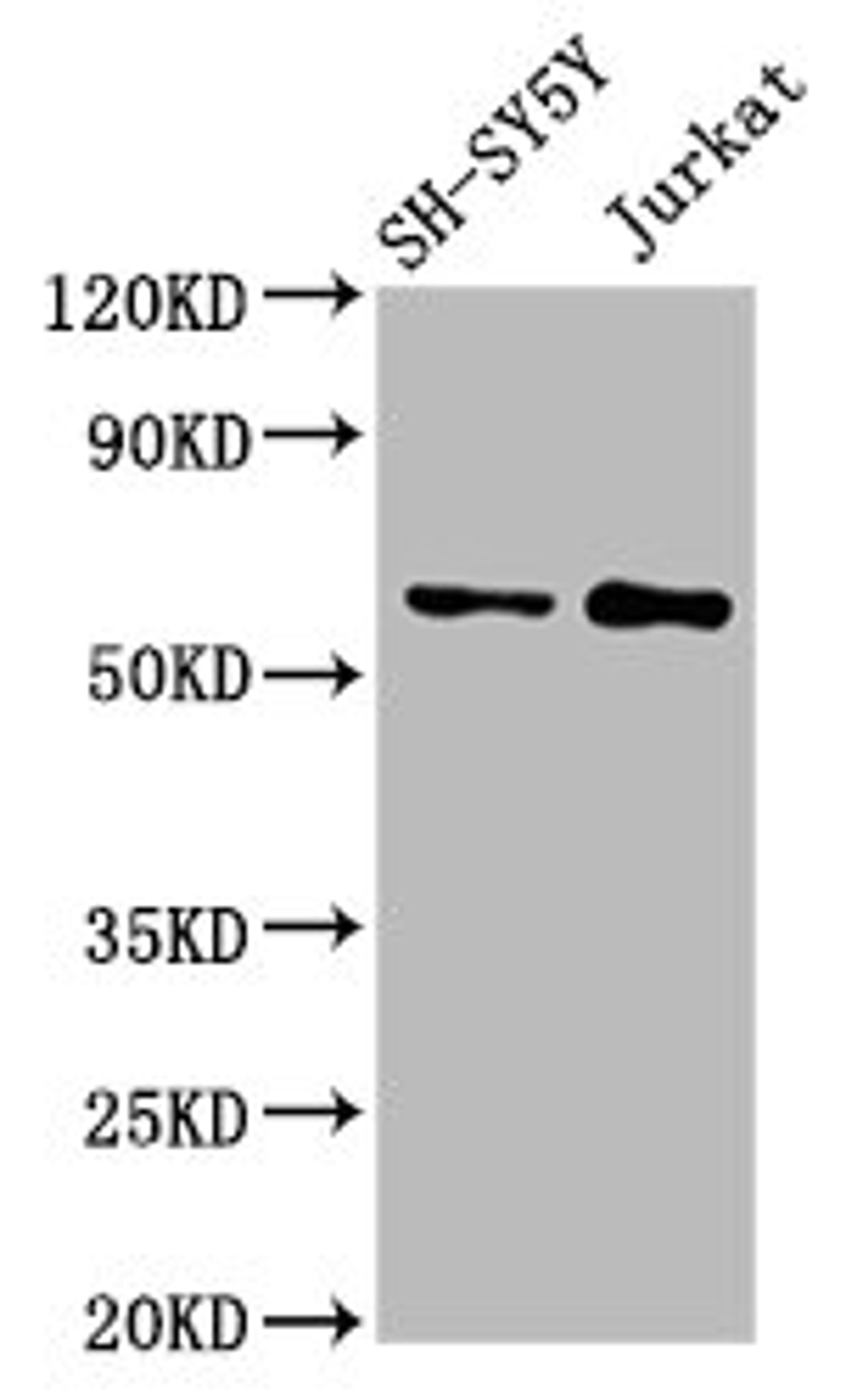 Western Blot. Positive WB detected in: SH-SY5Y whole cell lysate, Jurkat whole cell lysate. All lanes: MGAT4B antibody at 3µg/ml. Secondary. Goat polyclonal to rabbit IgG at 1/50000 dilution. Predicted band size: 64, 65 kDa. Observed band size: 64 kDa