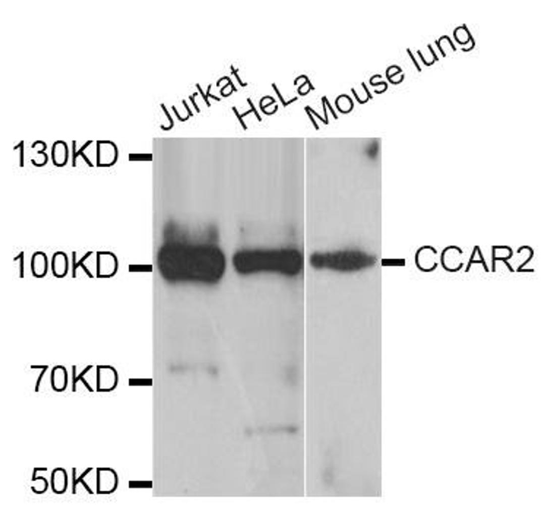 Western blot analysis of extracts of various cell lines using KIAA1967 antibody