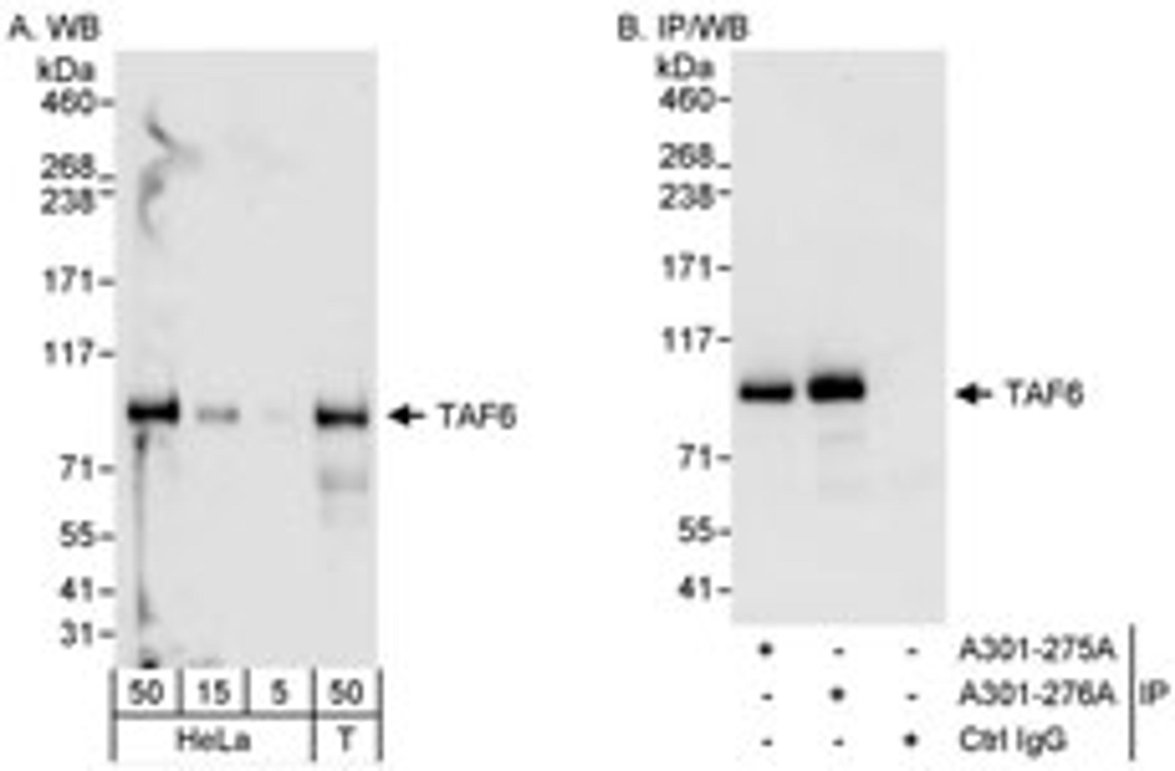 Detection of human TAF6 by western blot and immunoprecipitation.