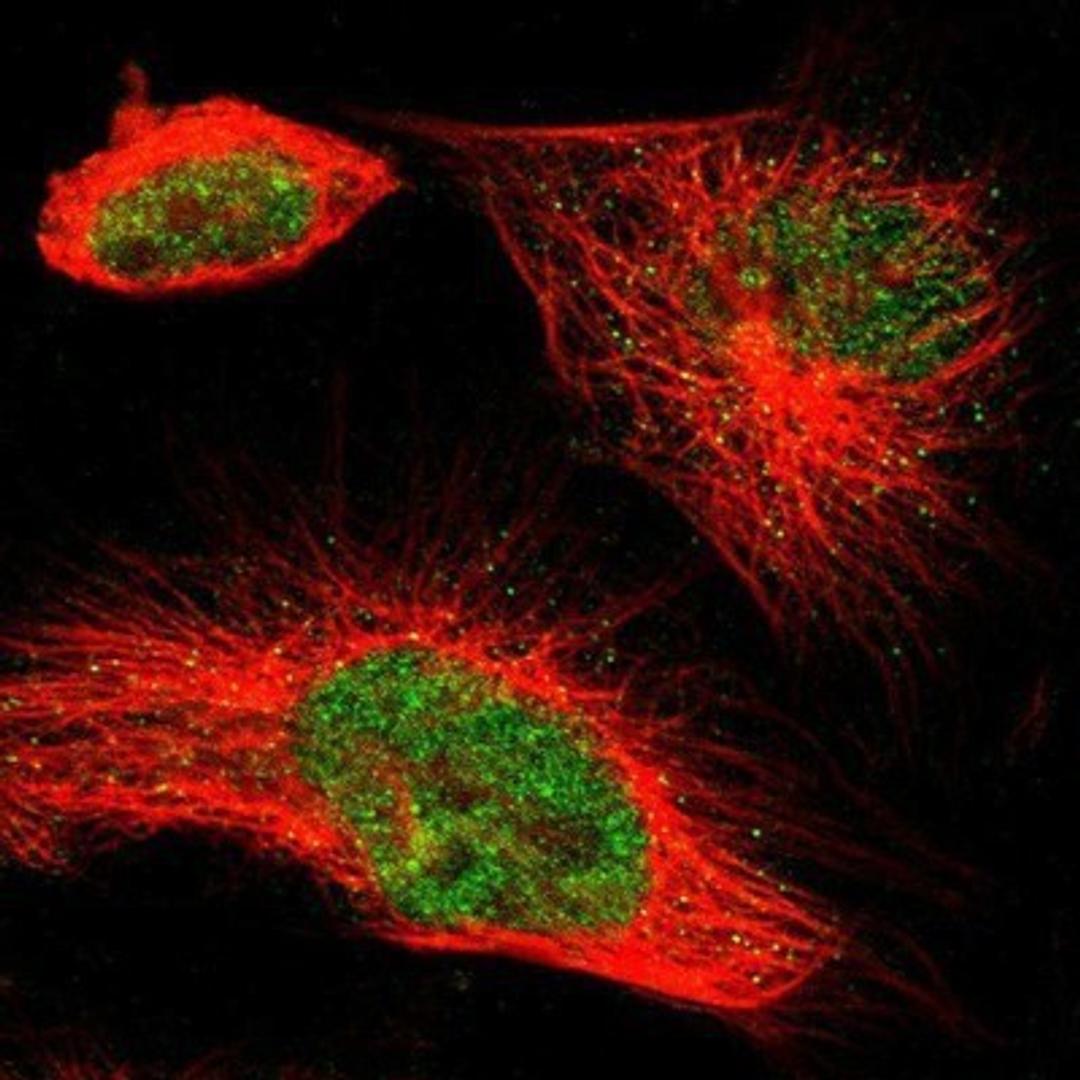 Immunocytochemistry/Immunofluorescence: TCF-2/HNF-1 beta Antibody [NBP1-89680] - Staining of human cell line U-251 MG shows positivity in nucleus but not nucleoli.