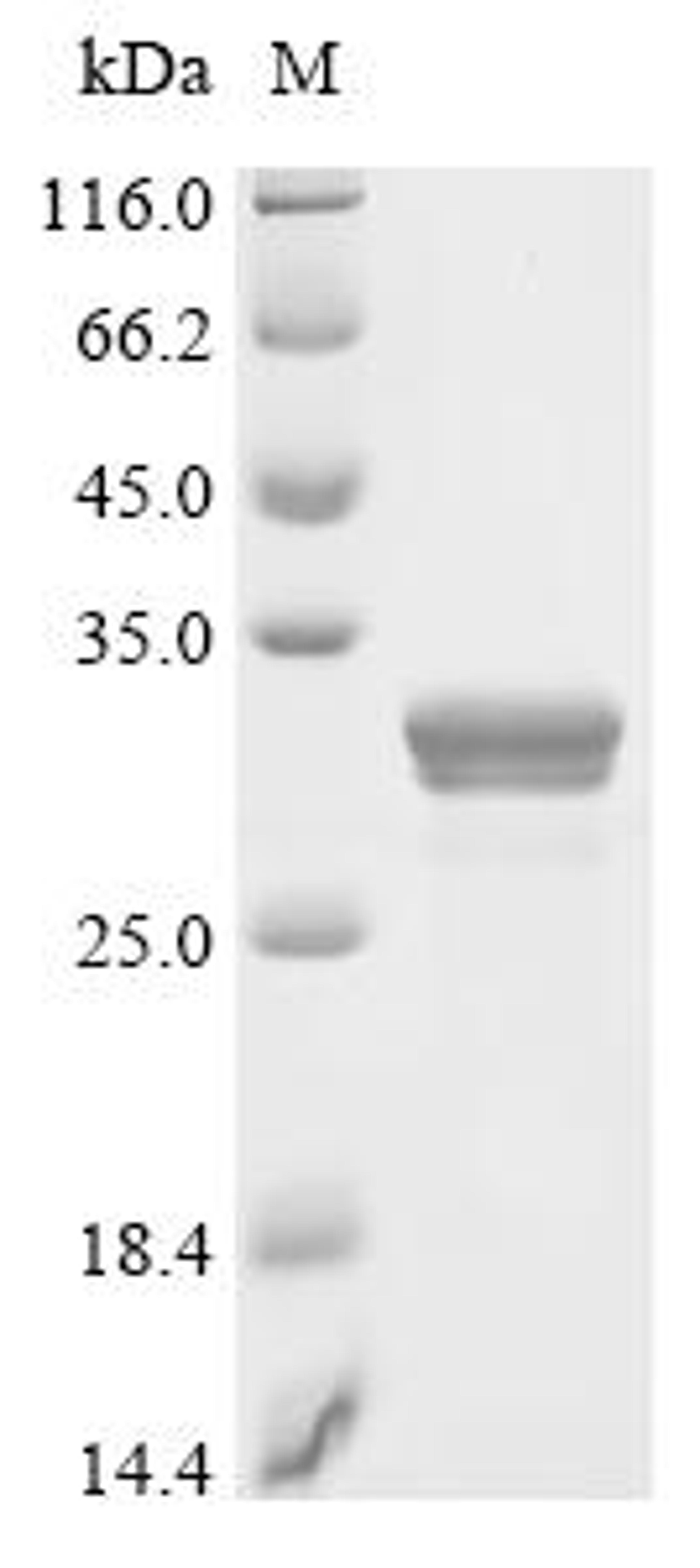 (Tris-Glycine gel) Discontinuous SDS-PAGE (reduced) with 5% enrichment gel and 15% separation gel.