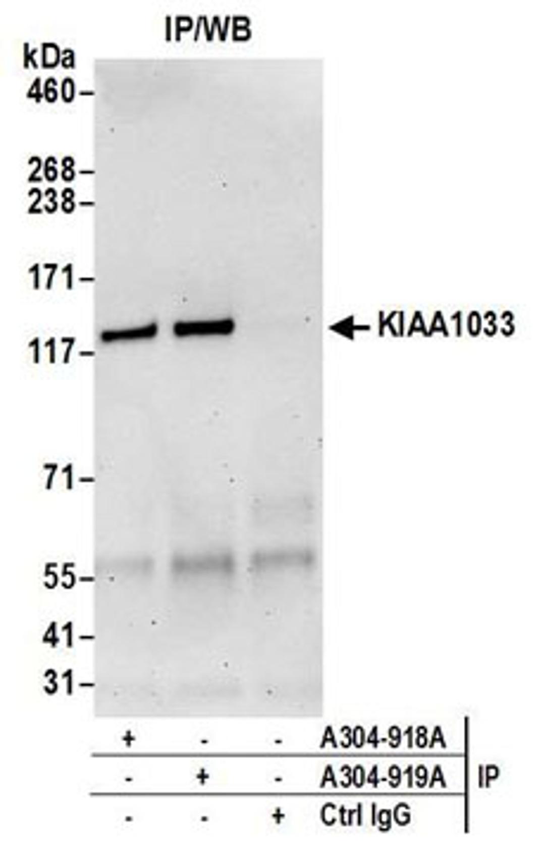 Detection of human KIAA1033 by western blot of immunoprecipitates.