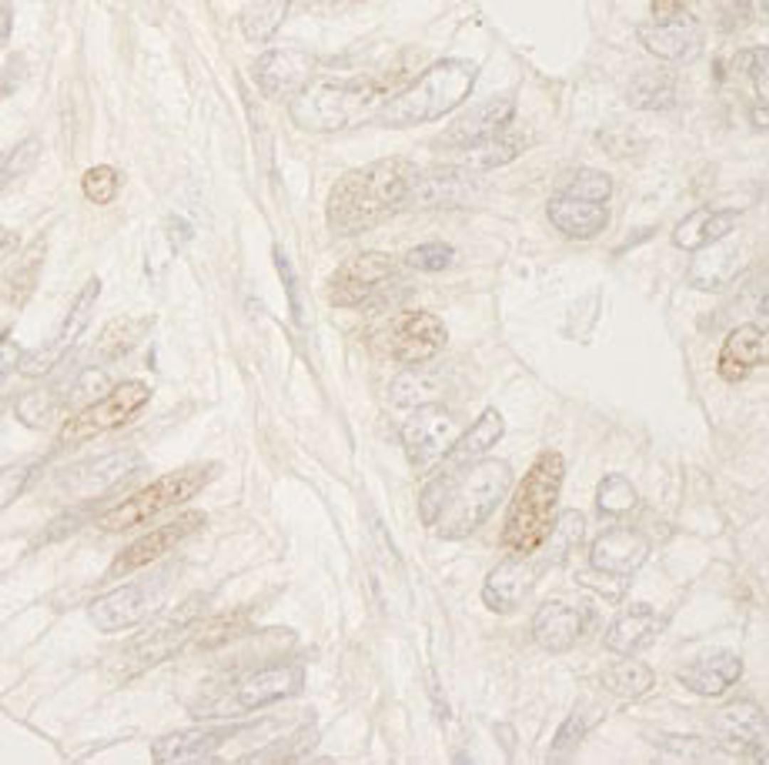 Detection of human APC by immunohistochemistry.