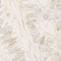 Detection of human APC by immunohistochemistry.