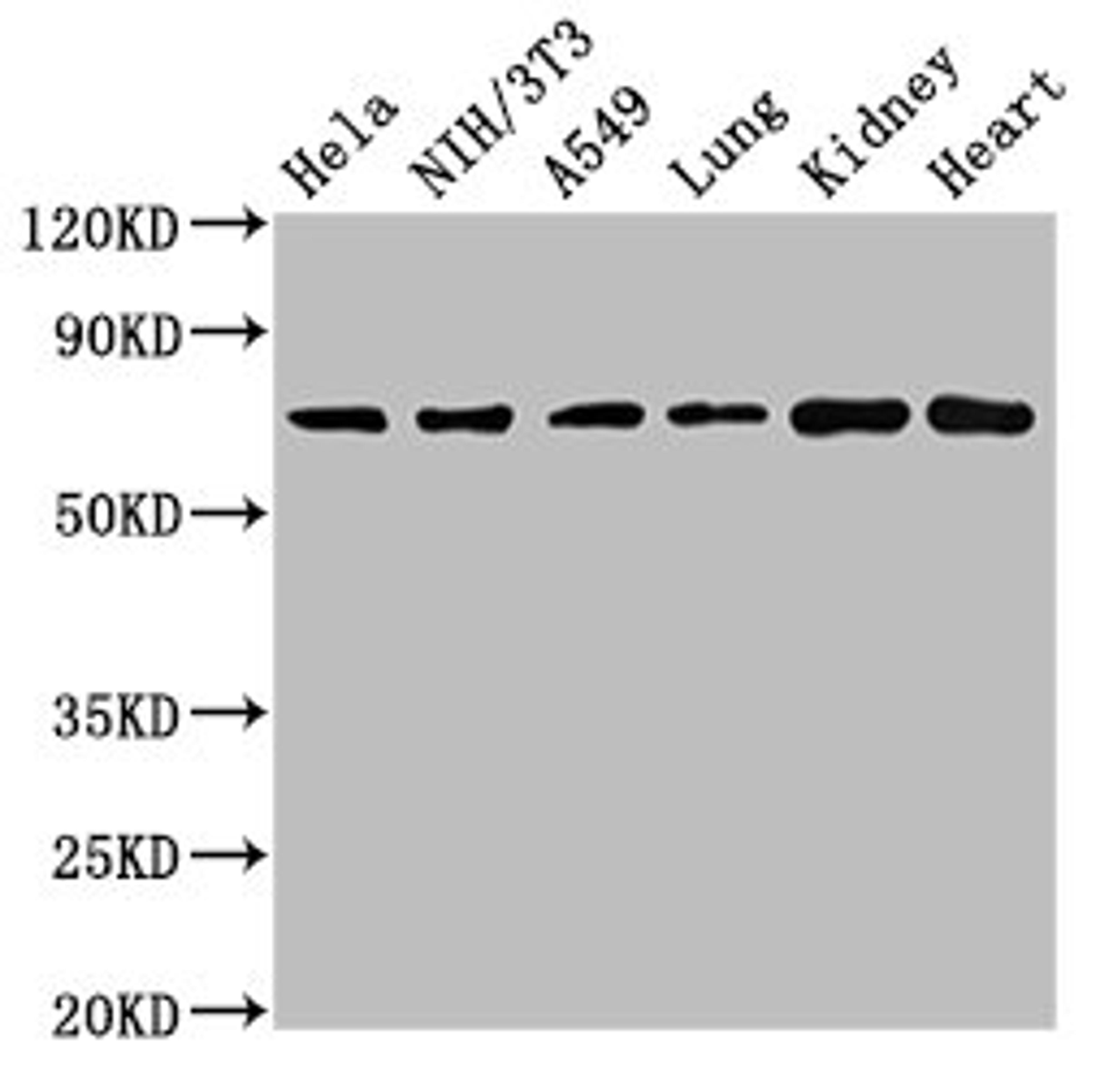 Western Blot. Positive WB detected in: Hela whole cell lysate, NIH/3T3 whole cell lysate, A549 whole cell lysate, Rat lung tissue, Rat kidney tissue, Mouse heart tissue. All lanes: ARHGAP18 antibody at 4.5µg/ml. Secondary. Goat polyclonal to rabbit IgG at 1/50000 dilution. Predicted band size: 75, 71 kDa. Observed band size: 75 kDa