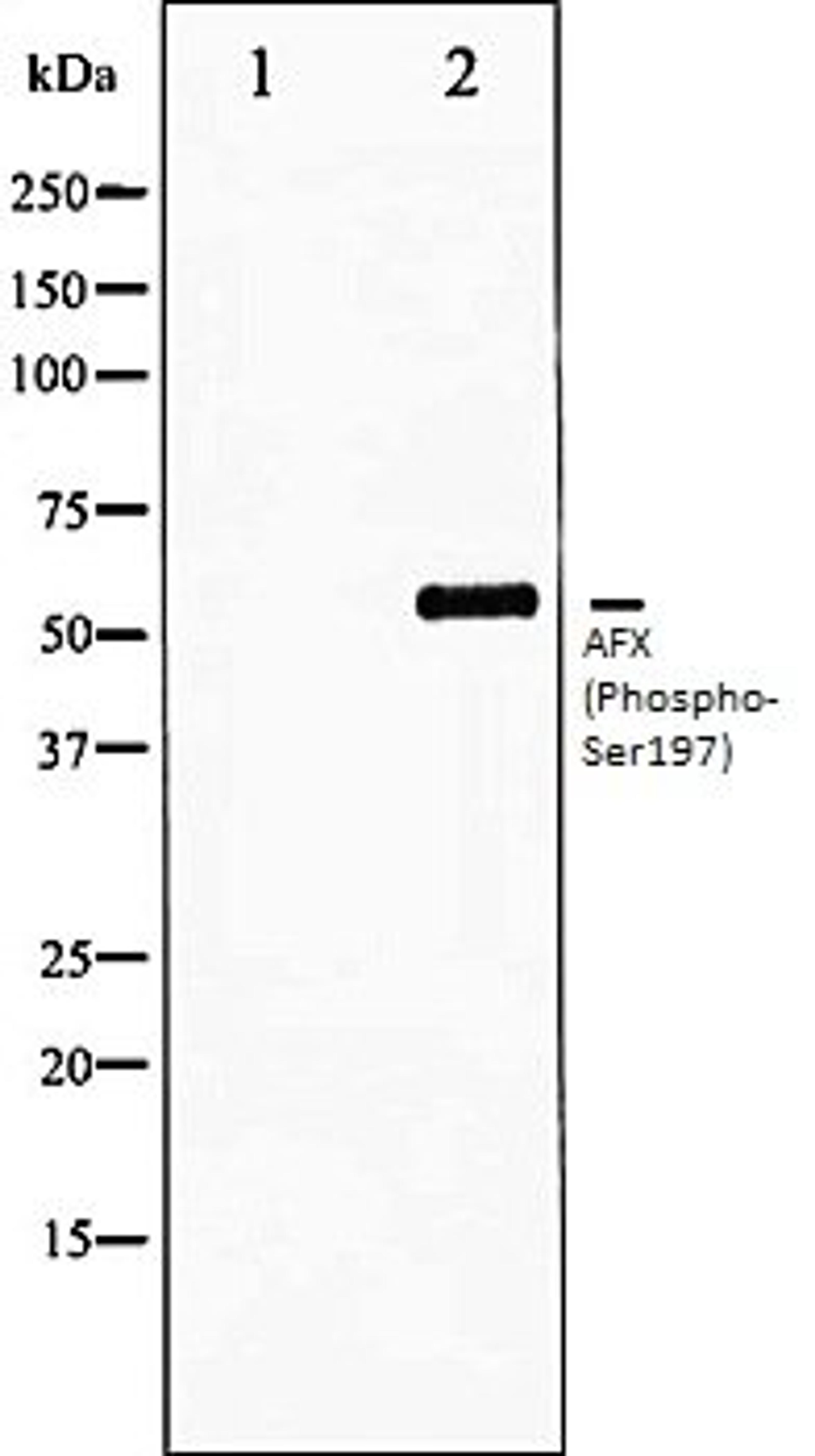 Western blot analysis of 293 whole cell lysates using AFX (Phospho-Ser197) antibody, The lane on the left is treated with the antigen-specific peptide.