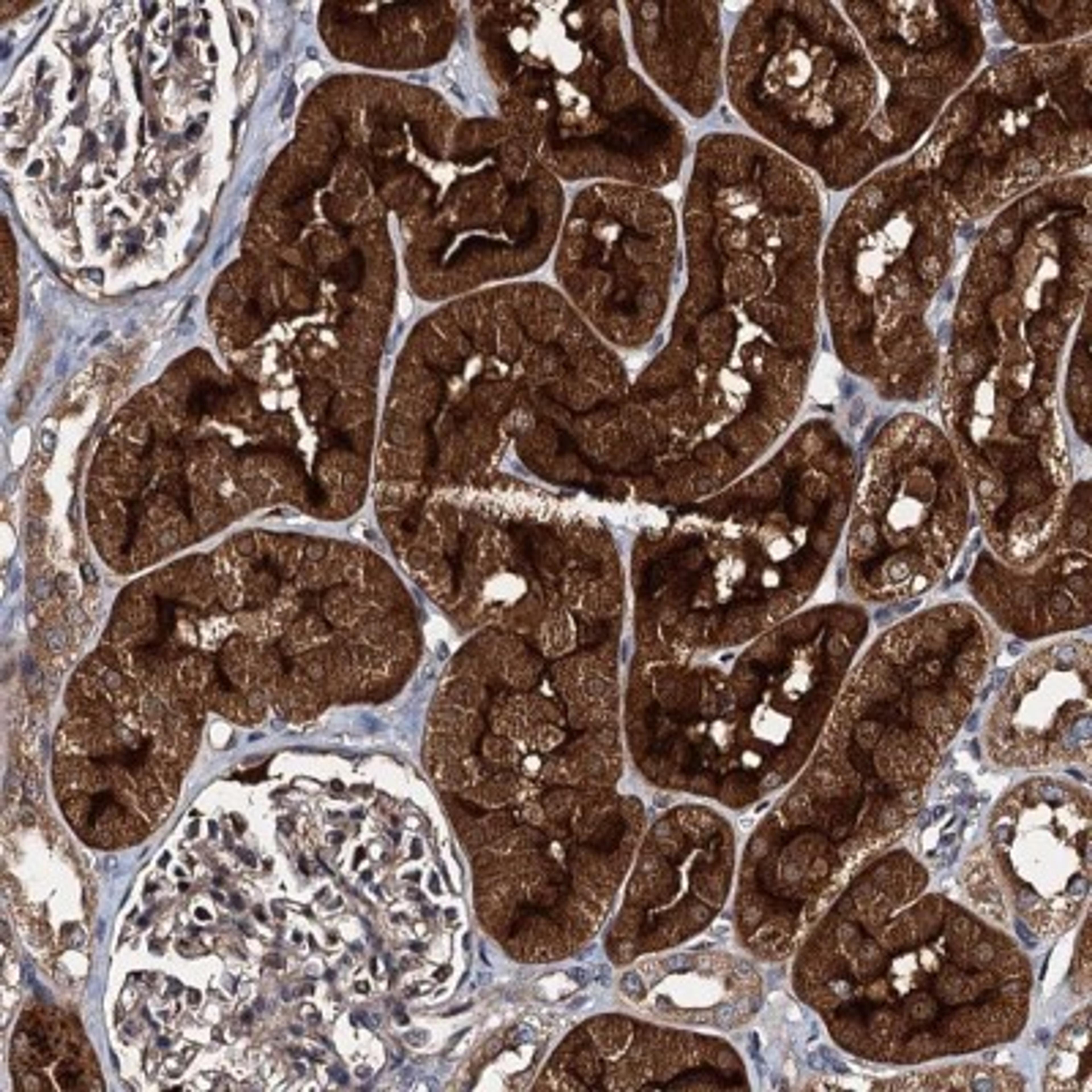 Immunohistochemistry: EFTUD1 Antibody [NBP2-32619] - Immunohistochemical staining of human kidney shows strong cytoplasmic and membranous positivity in tubules.