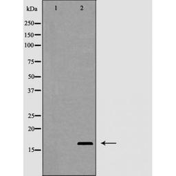 Western blot analysis of HT-29 cells using Interleukin 2 antibody