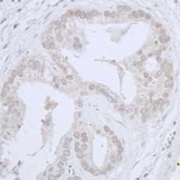 Detection of human CDC20 by immunohistochemistry.