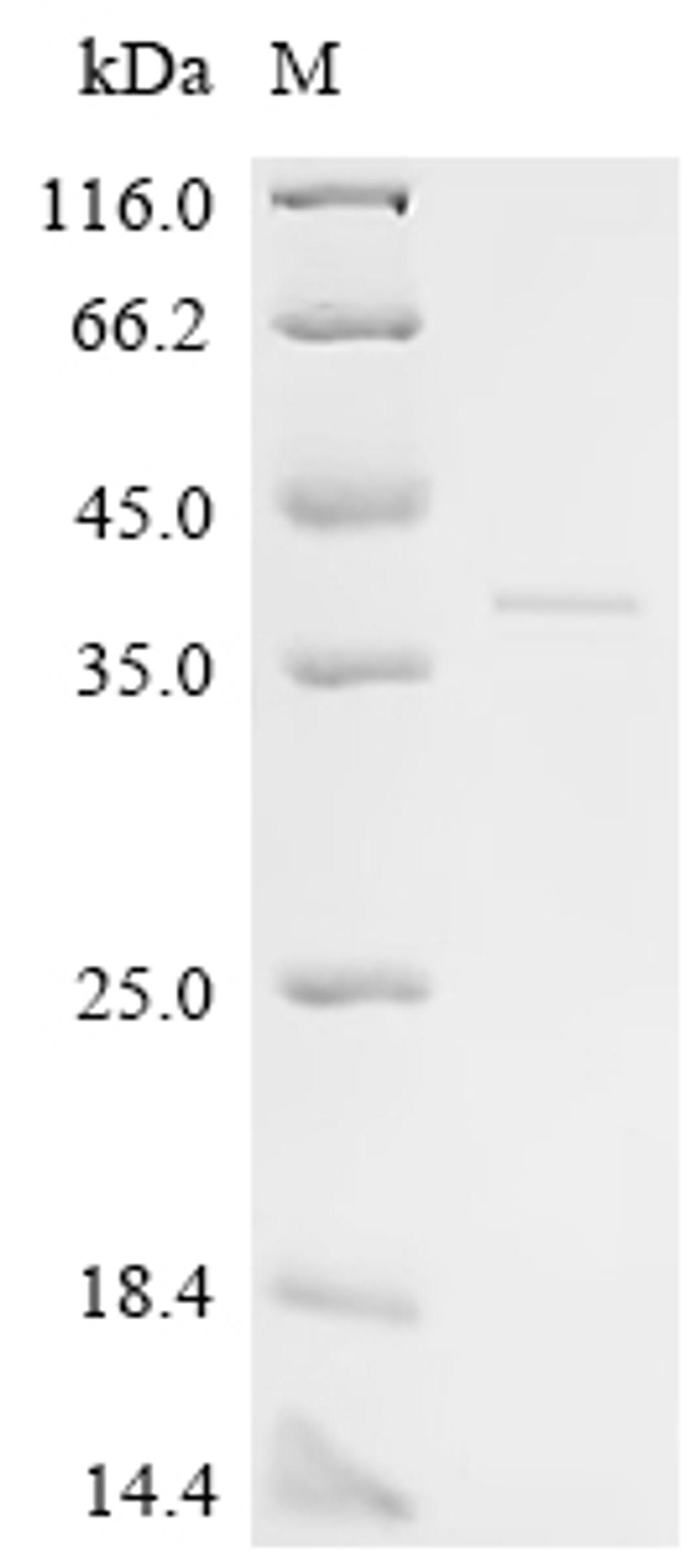 (Tris-Glycine gel) Discontinuous SDS-PAGE (reduced) with 5% enrichment gel and 15% separation gel.