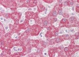 Immunohistochemistry-Paraffin: Leukotriene B4 Receptor 1 Antibody [NBP2-27422] - Analysis of human liver using BLT1 antibody at 10 ug/ml.