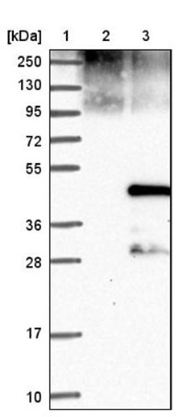 Western Blot: Cyclin J Antibody [NBP1-90019] - Lane 1: Marker [kDa] 250, 130, 95, 72, 55, 36, 28, 17, 10<br/>Lane 2: Negative control (vector only transfected HEK293T lysate)<br/>Lane 3: Over-expression lysate (Co-expressed with a C-terminal myc-DDK tag (~3.1 kDa) in mammalian HEK293T cells, LY412767)