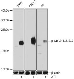 Western blot - Phospho-MYL9-T18/S19 antibody (AP0955)