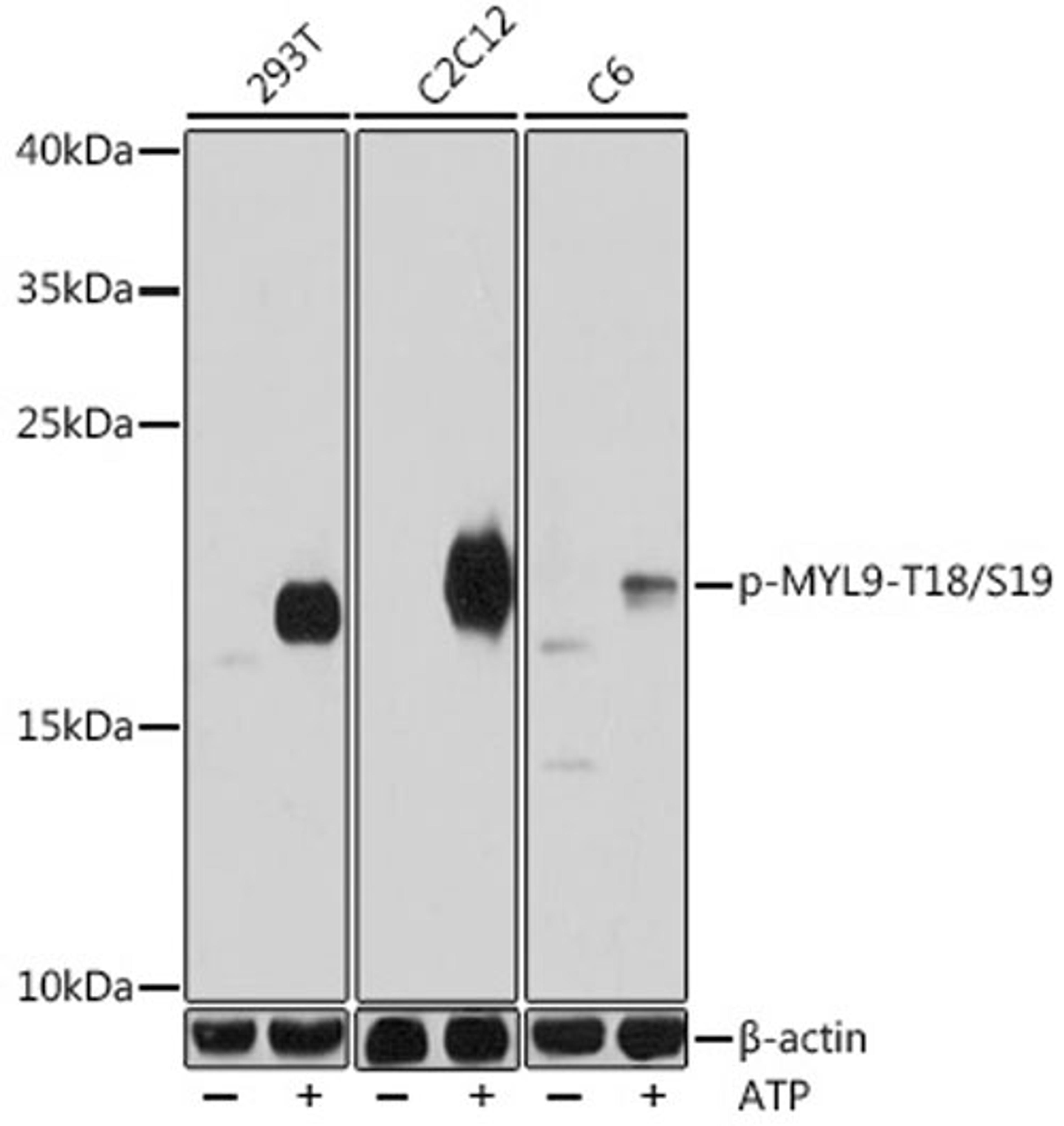 Western blot - Phospho-MYL9-T18/S19 antibody (AP0955)