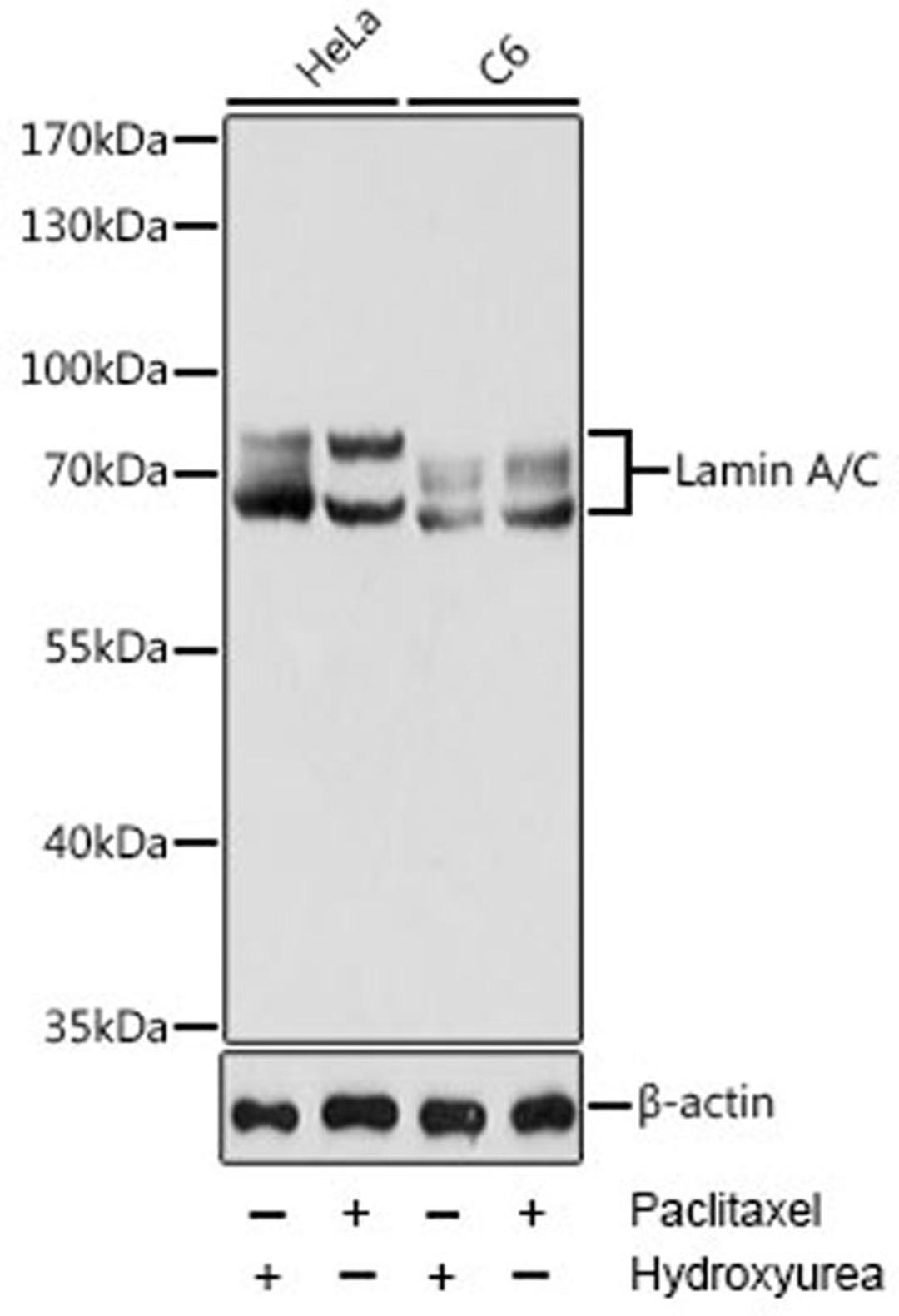 Western blot - Lamin A/C antibody (A0249)