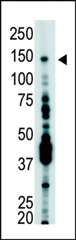 Antibody is used in Western blot to detect USP7 in T-47D cell lysate.