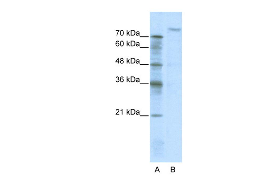 Antibody used in WB on Human Jurkat 5.0 ug/ml.