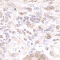 Detection of mouse CSTF50 by immunohistochemistry.