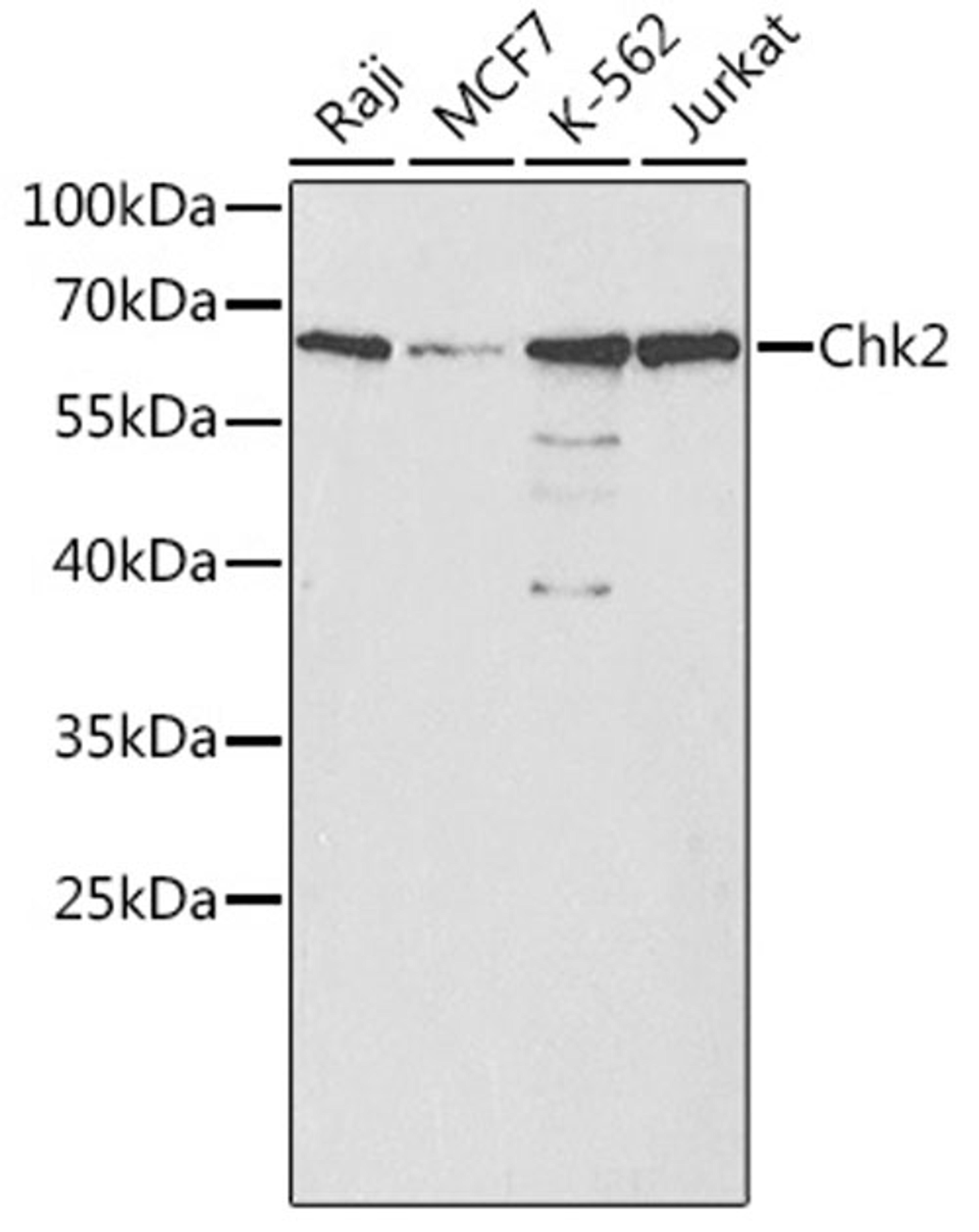 Western blot - Chk2 antibody (A0466)