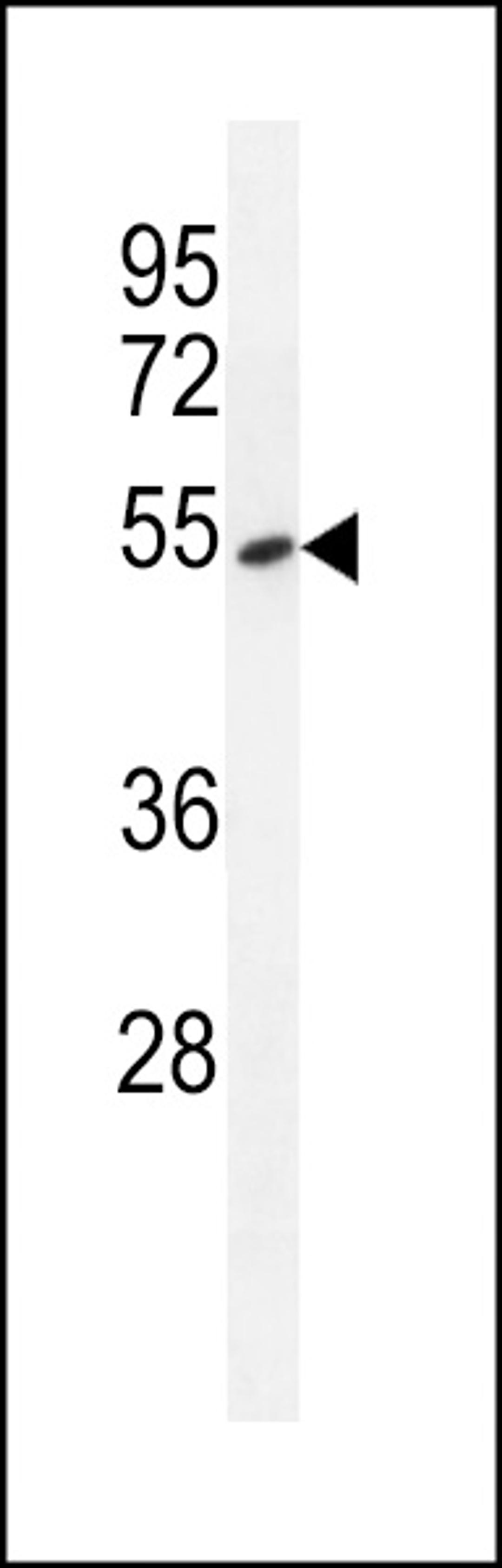 Western blot analysis in A549 cell line lysates (35ug/lane).