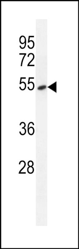 Western blot analysis in A549 cell line lysates (35ug/lane).