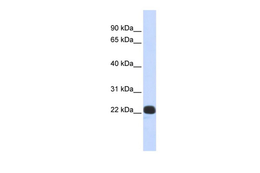 Antibody used in WB on Human Placenta at 0.2-1 ug/ml.