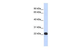 Antibody used in WB on Human Placenta at 0.2-1 ug/ml.