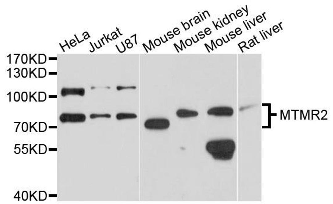 Western blot analysis of extracts of various cells using MTMR2 antibody