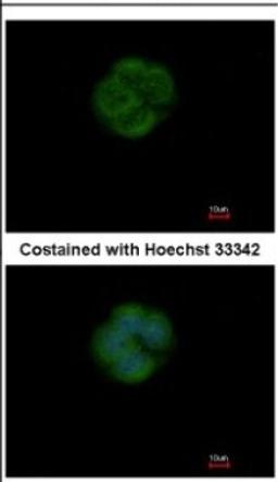 Immunocytochemistry/Immunofluorescence: EFHA1 Antibody [NBP2-16278] - Immunofluorescence analysis of methanol-fixed MCF-7, using antibody at 1:200 dilution.