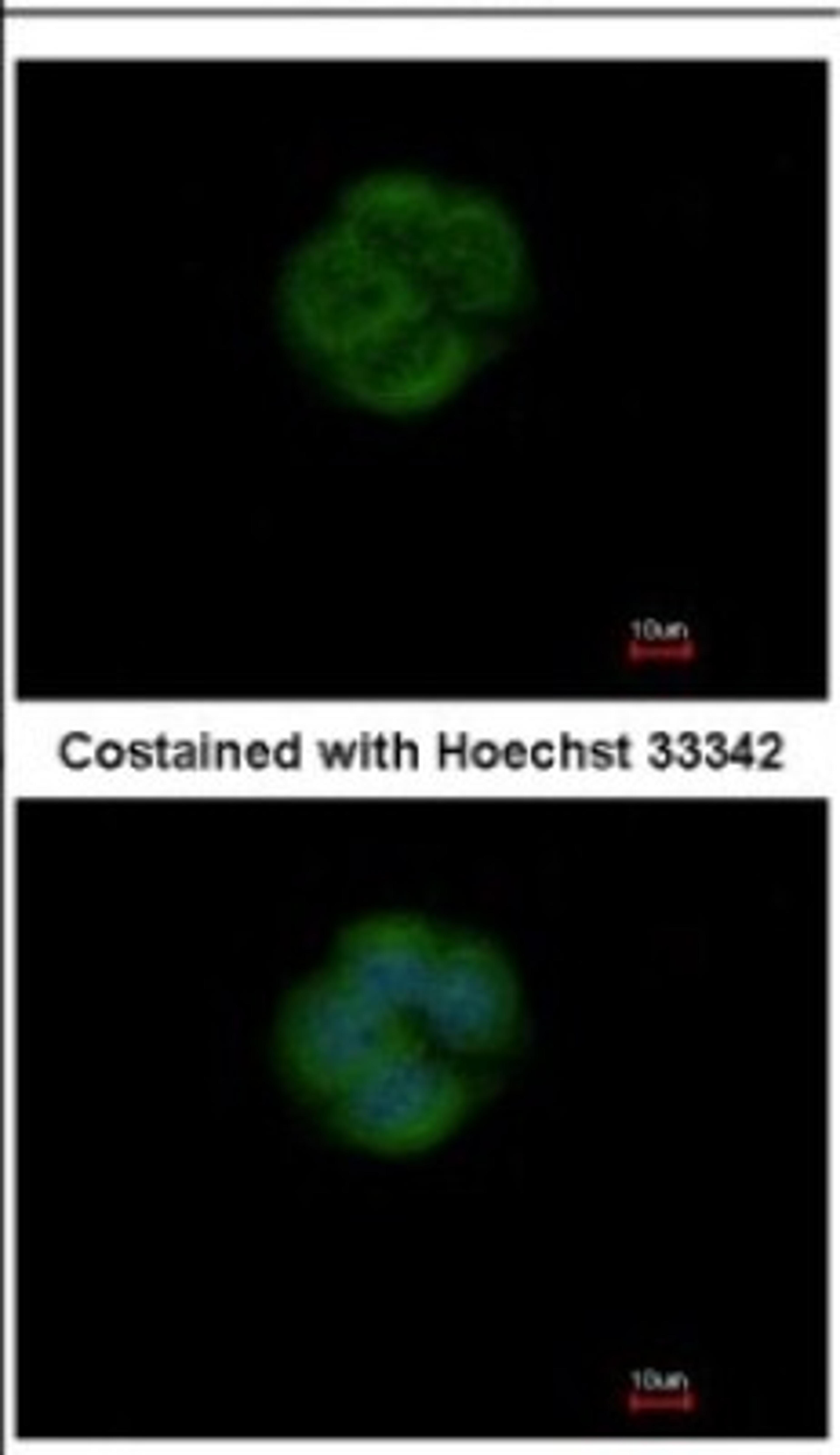 Immunocytochemistry/Immunofluorescence: EFHA1 Antibody [NBP2-16278] - Immunofluorescence analysis of methanol-fixed MCF-7, using antibody at 1:200 dilution.