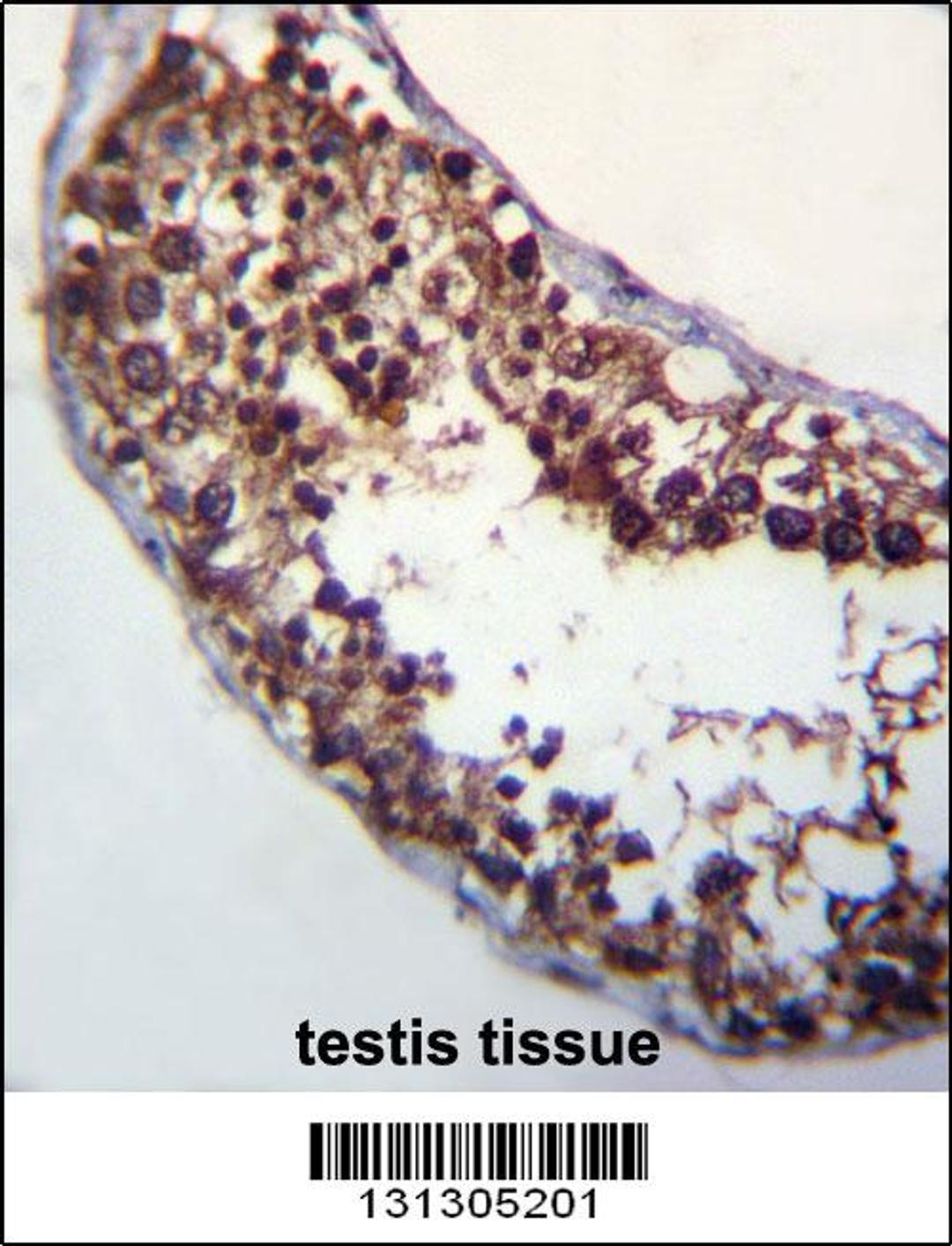 POMT1 Antibody immunohistochemistry analysis in formalin fixed and paraffin embedded human testis tissue followed by peroxidase conjugation of the secondary antibody and DAB staining.