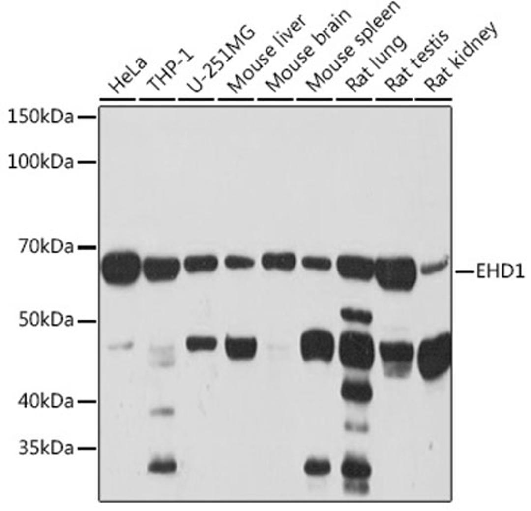 Western blot - EHD1 Rabbit mAb (A3496)