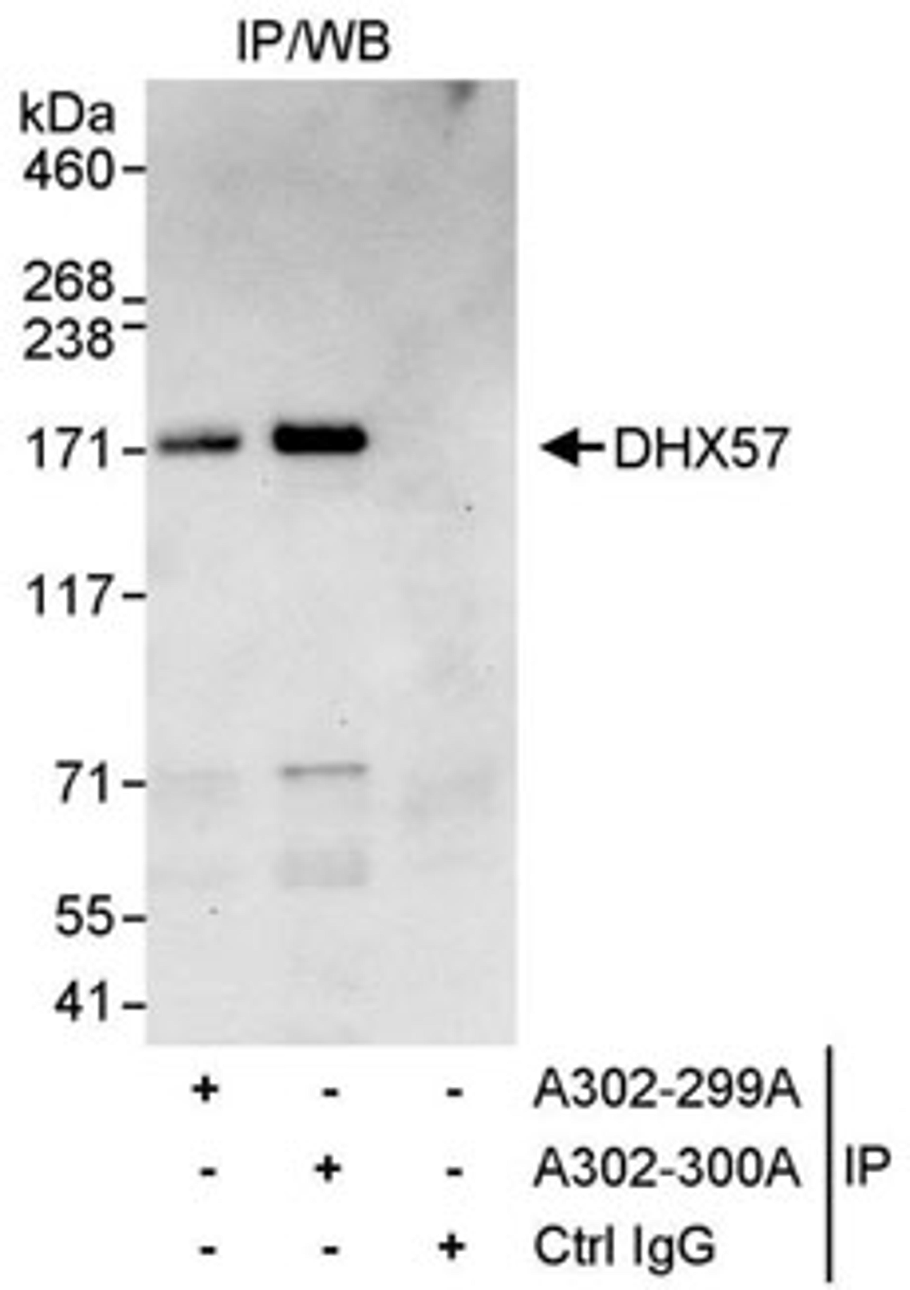 Detection of human DHX57 by western blot of immunoprecipitates.