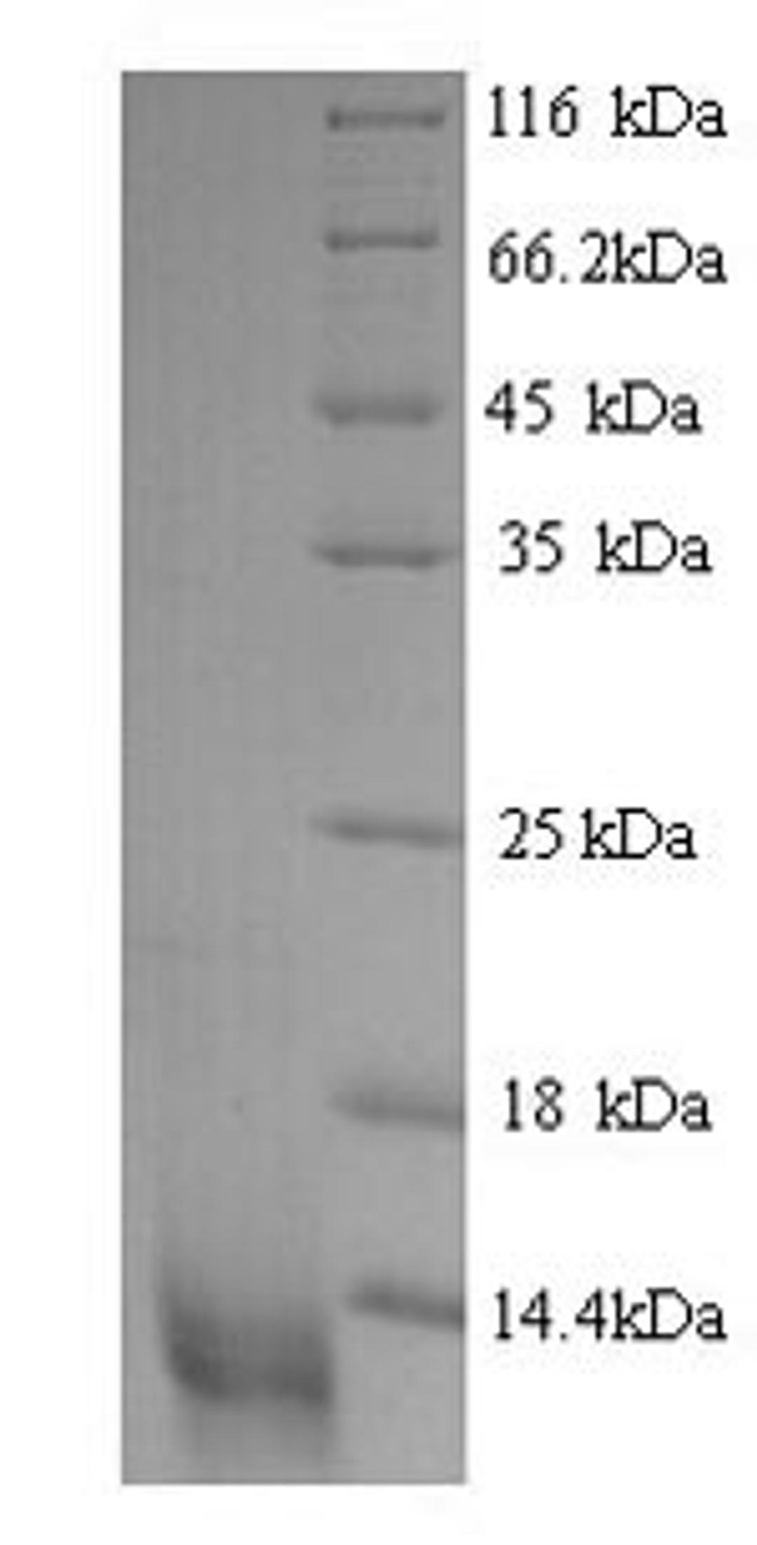 (Tris-Glycine gel) Discontinuous SDS-PAGE (reduced) with 5% enrichment gel and 15% separation gel.