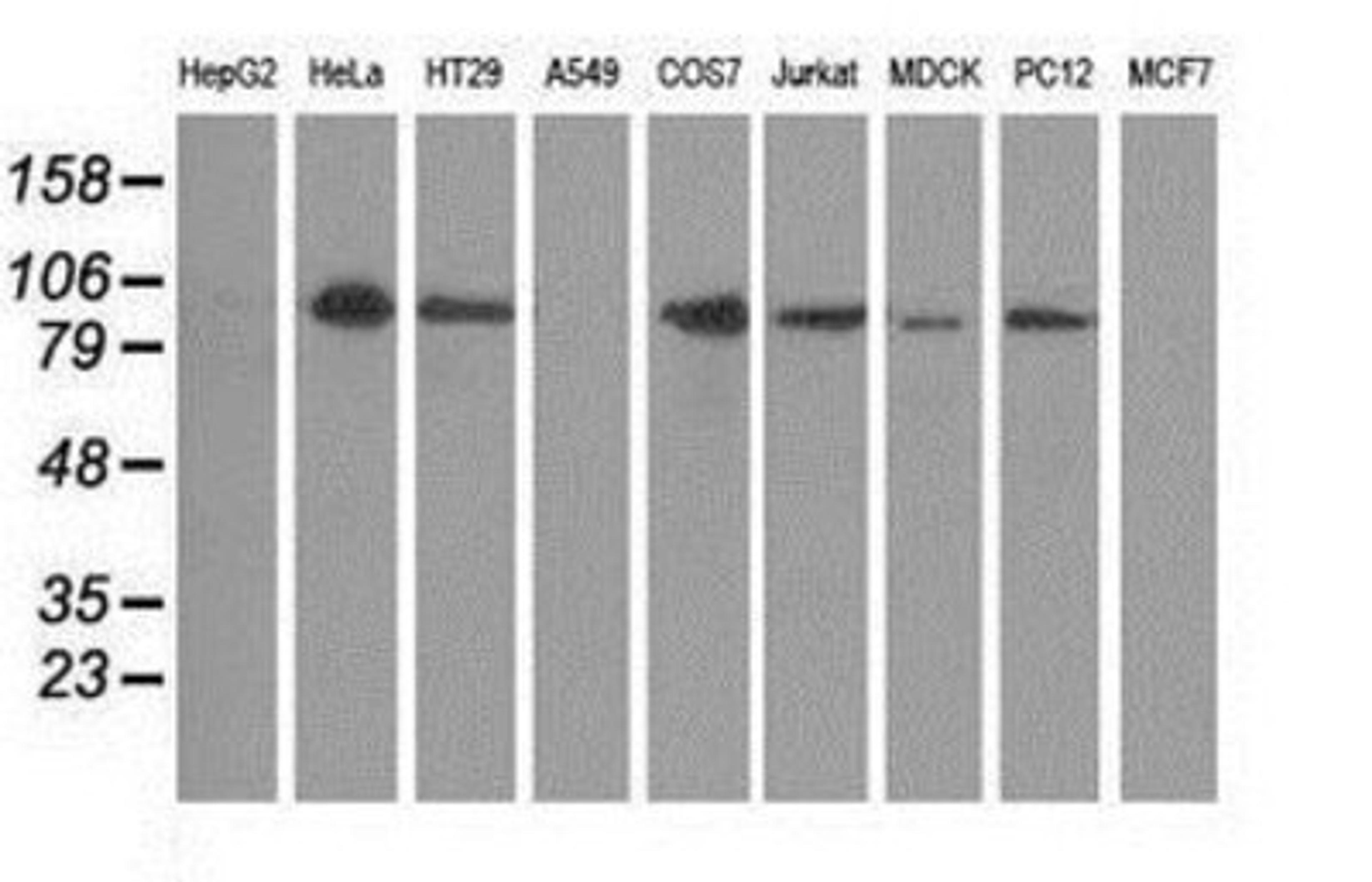 Western Blot: Protein Kinase D2 Antibody (5G1) [NBP2-02984] Analysis of extracts (35ug) from 9 different cell lines by using anti-Protein Kinase D2 monoclonal antibody.