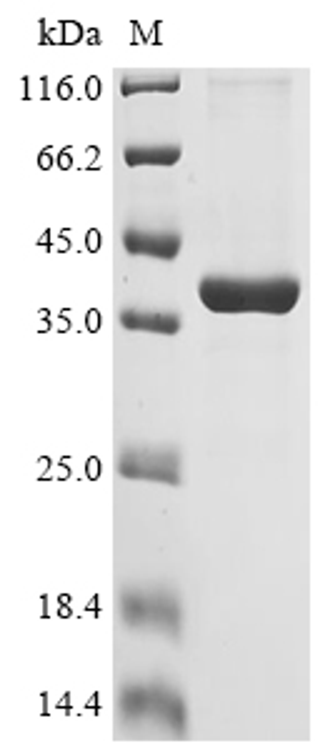 (Tris-Glycine gel) Discontinuous SDS-PAGE (reduced) with 5% enrichment gel and 15% separation gel.